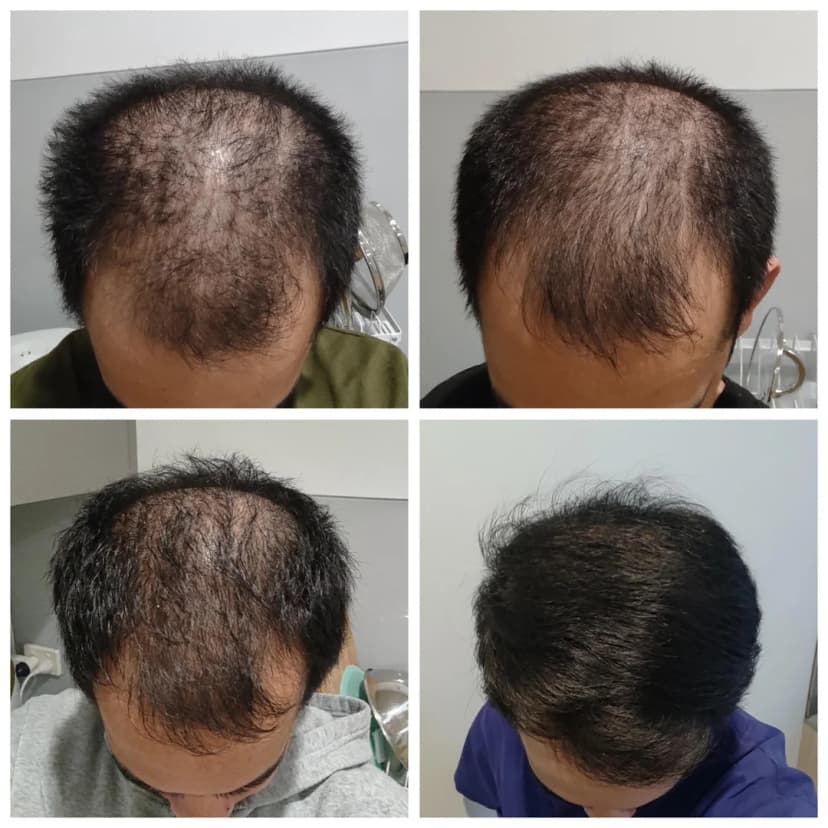 My Hair Transformation